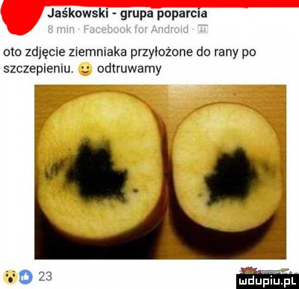 jaśkowski grupa poparcia oto zdjęcie ziemniaka przyłożone do rany po szczepieniu. odtruwamy