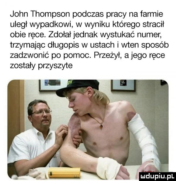 john thompson podczas pracy na farmie uległ wypadkowi w wyniku którego stracił obie ręce. zdołał jednak wystukać numer trzymając długopis w ustach i wien sposób zadzwonić po pomoc. przeżył a jego ręce zostały przyszyte