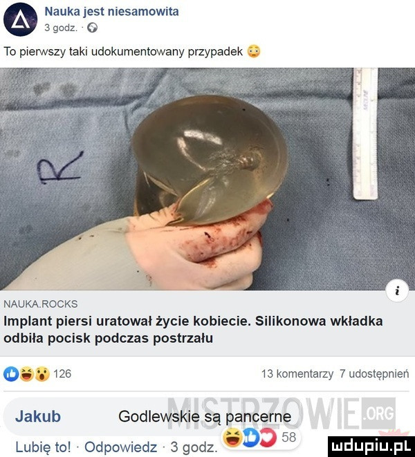 nauka jest niesamowita   godz   to pierwszy taki udokumentowany przypadek naukąrocks implant piersi uratował życie kobiecie. silikonowa wkładka odbiła pocisk podczas postrzału o        komentarzy  udostępnień jakub godlewskie są pancerne lubię to odpowiedz sgodz. a