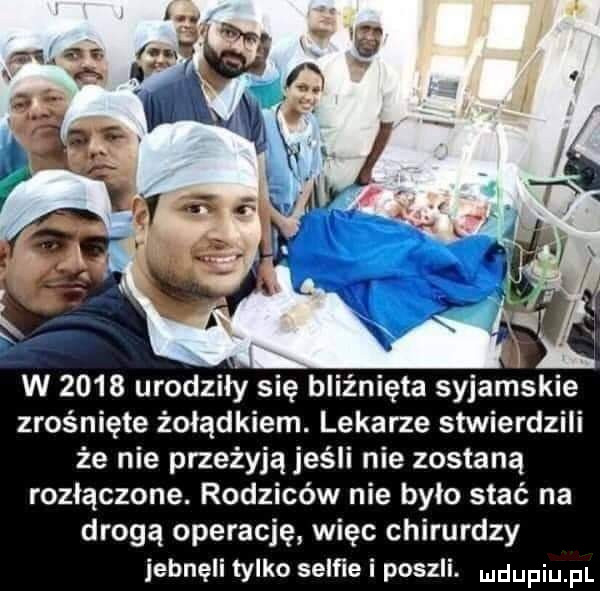 w      urodziły się bliźnięta syjamskie zrośnięte żołądkiem. lekarze stwierdzili że nie przeżyją jeśli nie zostaną rozłączone. rodziców nie było stać na drogą operację więc chirurdzy jebnęli tylko selﬁe i poszli. ndufiu fl