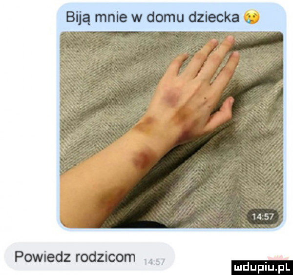 biją mnie w domu dziecka powiedz rodzicom. abakankami mduplu pl