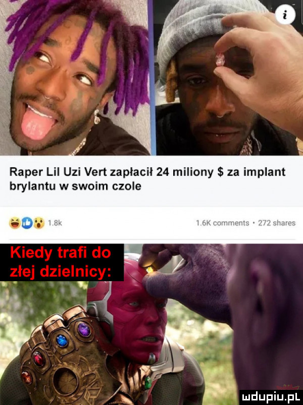 raper lil uzi vert zapłacił    miliony za implant brylantu w swoim czole ó