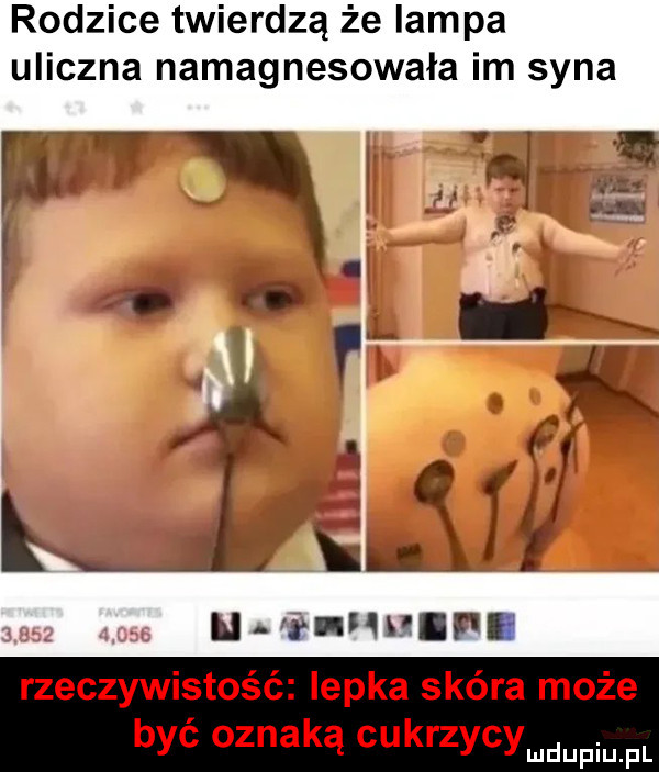 rodzice twierdzą że lampa uliczna namagnesowała im syna rafą c   u lhhife rzeczywistość lepka skóra może być oznaką cukrzycymdupiu fl
