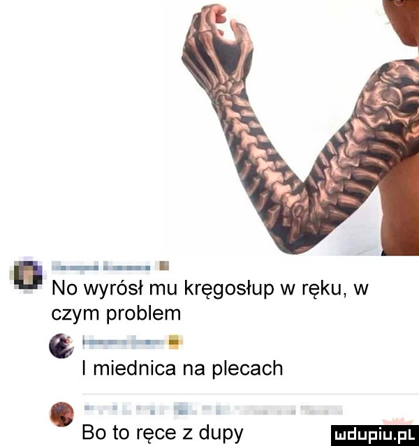 no wyrósł mu kręgosłup w ręku w czym problem l. e. i miednica na plecach bo to ręce z dupy