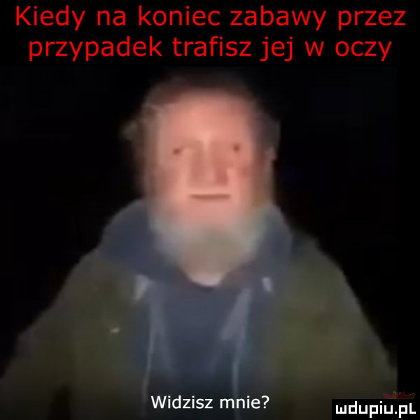 kiedy na koniec zabawy przez przypadek trafisz jej w oczy widzisz mnie udupiu pl