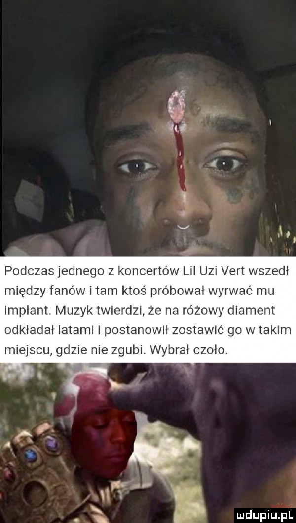 podczas jednego z koncertów lil uzi vert wszedł między fanów imam ktoś próbował wyrwać mu implant. muzyk twierdzi że na różowy diament odkładał latami i postanowił zostawić go w takim miejscu gdzie nie zgubi. wybrał czoło mdupiupi