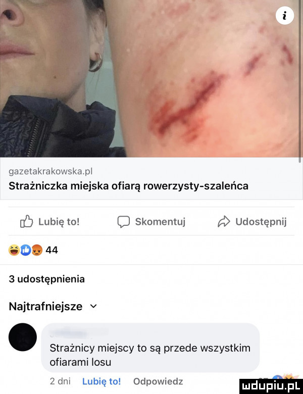 ik gazetakrakowskap strażniczka miejska ofiarą rowerzysty szaleńca c lubię to c skomentuj udostępnij an.      udostępnienia najtrafniejsze v. strażnicy miejscy to są przede wszystkim ofiarami losu zbm lunięto odpowiedz m