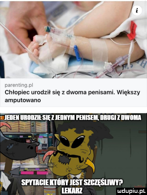 ix  l        narmmm m chłopiec urodził się z dwoma penisami. większy amputowano ici llllll sci ieiiiyi i eiisei. iiiiiei l iii i    xx ne ilii iiiyiestsigęśhwy ehm