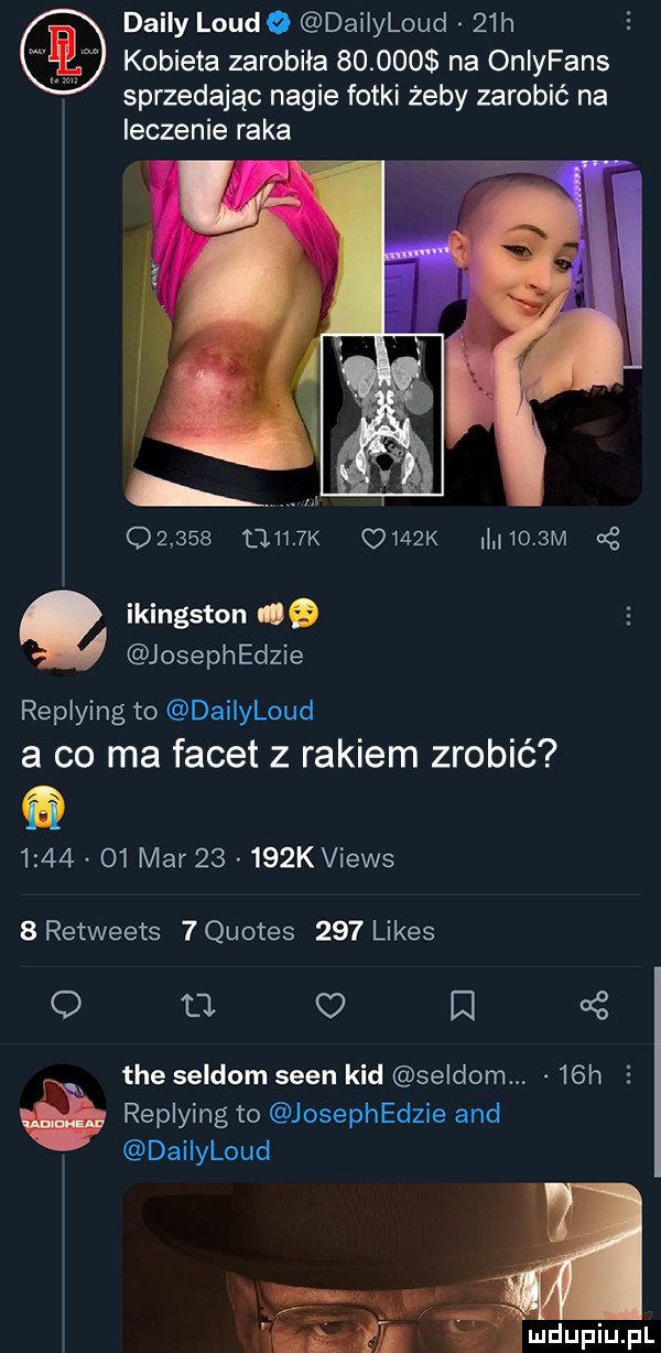 dainy loude daiiyloud   h e kobieta zarobiła        na oniyfans sprzedając nagie fotki żeby zarobić na leczenie raka        ciuk o   k     m oł ikingston   joseph edzie replying to dailyloud a co ma facet z rakiem zrobić         mar       k views   retweets   quotes     limes o ll c i   tee saldom scen kad saldom.   h   a replying to josephedzie and daiiyloud