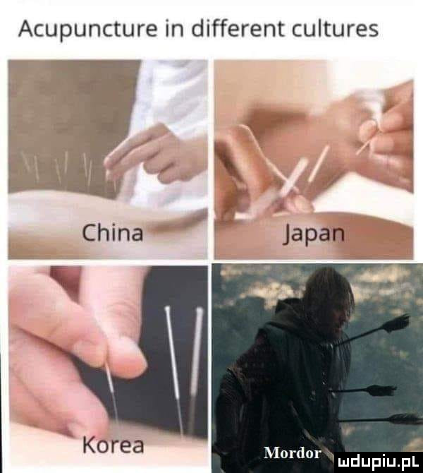 acupuncture in different cultures murger