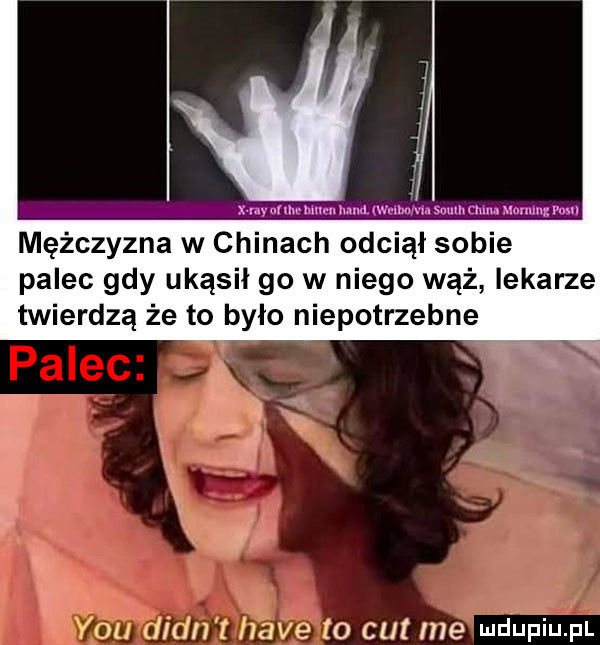 mężczyzna w chinach odciął sobie palec gdy ukąsil go w niego wąż lekarze twierdzą że to było niepotrzebne fon lir z mae to cat me