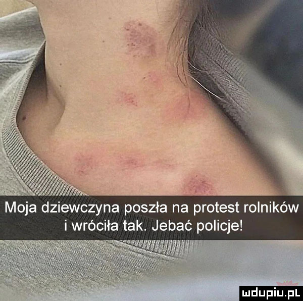 i wróciła tak. jebać policje ludu iu. l