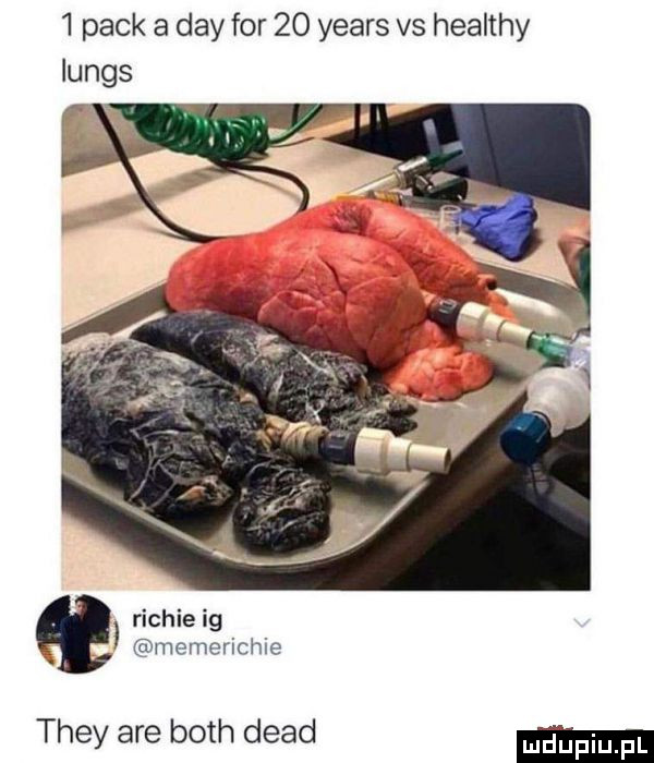 peck a dcy for    yeats vs healthy lungs richie ig memerichie they are bath diad