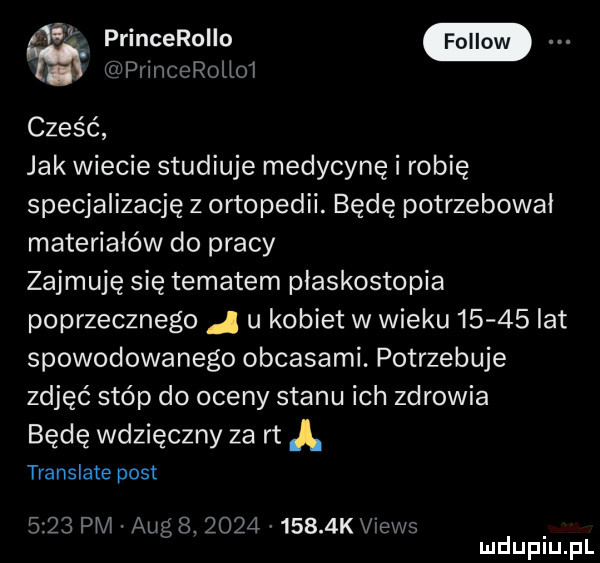 princerollo tćriprincerolioi cześć jak wiecie studiuje medycynę i robię specjalizację z ortopedii. będę potrzebował materiałów do pracy zajmuję się tematem płaskostopia poprzecznego j u kobiet w wieku       lat spowodowanego obcasami. potrzebuje zdjęć stóp do oceny stanu ich zdrowia będę wdzięczny za rt a translate post      pm aeg s.      v     k views mduplu pl