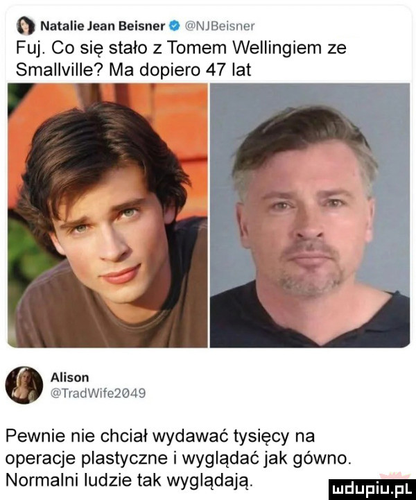 natalie jean beisnev o njbeisner fuj co się stało z tomem wellingiem ze smallville ma dopiero    lat v v alison tradwife     pewnie nie chcial wydawać tysięcy na operacje plastyczne i wyglądać jak gówno. normalni ludzie tak wyglądają