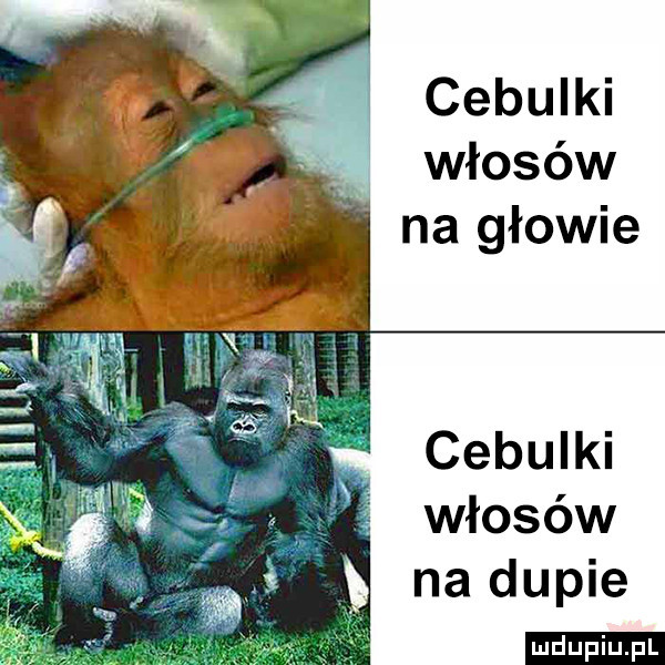 cebulki włosów na głowie
