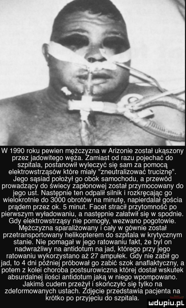 w      roku pewien mężczyzna w arizonie został ukąszony przez jadowitego węża. zamiast od razu pojechać do szpitala postanowił wyleczyć się sam za pomocą elektrowstrząsów które miały zneutralizować truciznę. jego sąsiad położył go obok samochodu a przewód prowadzący do świecy zapłonowej został przymocowany do jego ust następnie ten odpalił silniki rozkręcając go wielokrotnie do      obrotów na minutę napierdalał gościa prądem przez ok.   minut. facet stracił przytomność po pierwszym wyładowaniu a następnie załatwił się w spodnie. gdy elektrowstrząsy nie pomogły wezwano pogotowie. mężczyzna sparahżowany caly w gównie został przetransportowany helikopterem do szpitala w krytycznym stanie. nie pomagał w jego ratowaniu fakt że byl on nadwrażliwy na antidotum najad którego przy jego ratowaniu wykorzystano aż    ampułek. gdy nie zabił go jad to   dni później próbował go zabić szok anatiaktyczny a potem z kolei choroba postsurowiczna ktorej dostał wskutek absurdalnej ilości antidotum jaką w niego wpompowano. jakims cudem przeżyci skończyło się tylko na zdeformowanych ustach. zdjęcie przedstawia pacjenta na krótko po przyjęciu do szpitala