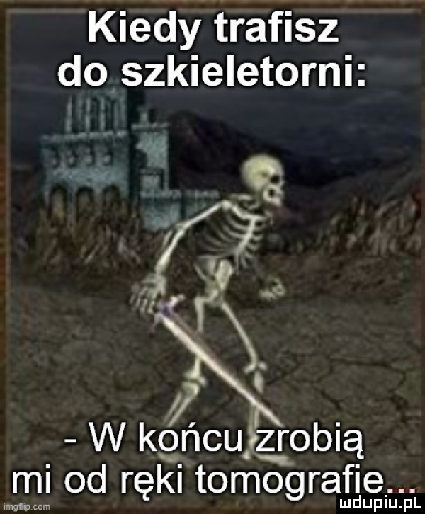 kiedy trafisz do szkieletorni   y w kgńcująobią mi od ręki tomografie. ąąąąąąąą