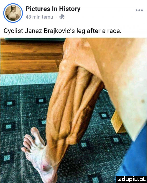 pictures in histony cyclist janez brajkovic s leg after a race